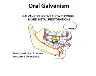 101114053743OralGalvanism